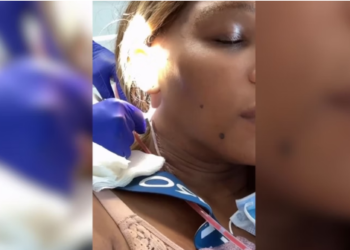 Ex-tenista Serena Williams passa por cirurgia para retirada de cisto