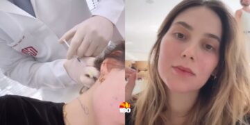 Virginia Fonseca surpreende seguidores ao compartilhar tratamento com injeções na cabeça