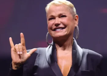Xuxa se recupera de cirurgia no joelho enquanto se prepara para turnê comemorativa