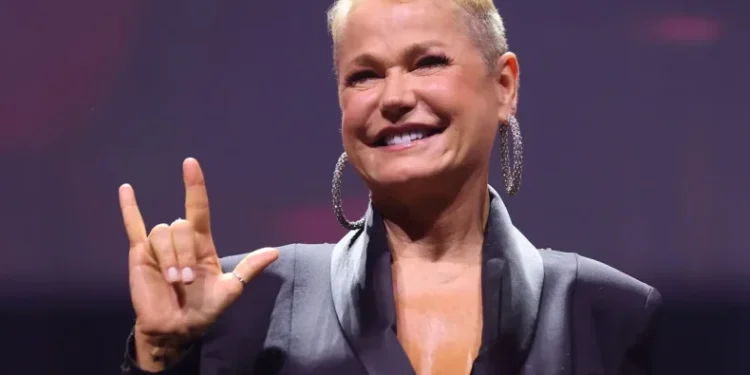 Xuxa se recupera de cirurgia no joelho enquanto se prepara para turnê comemorativa